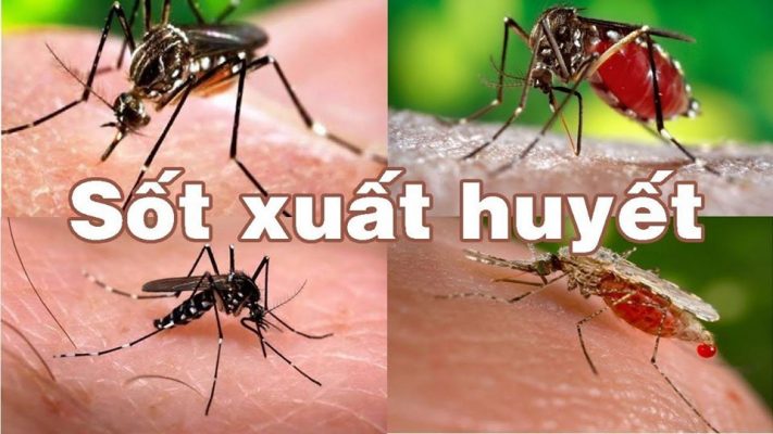 sốt xuất huyết